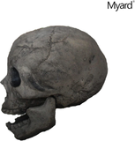 Myard Fireproof Imitated Human Fire Pit Skull Gas Log for NG, LP Wood Fireplace, Firepit, Campfire, Halloween Decor, BBQ (Qty 1, Aged Dark Grey Skull)